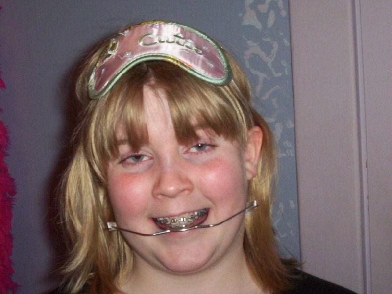 shelbybraces.jpg